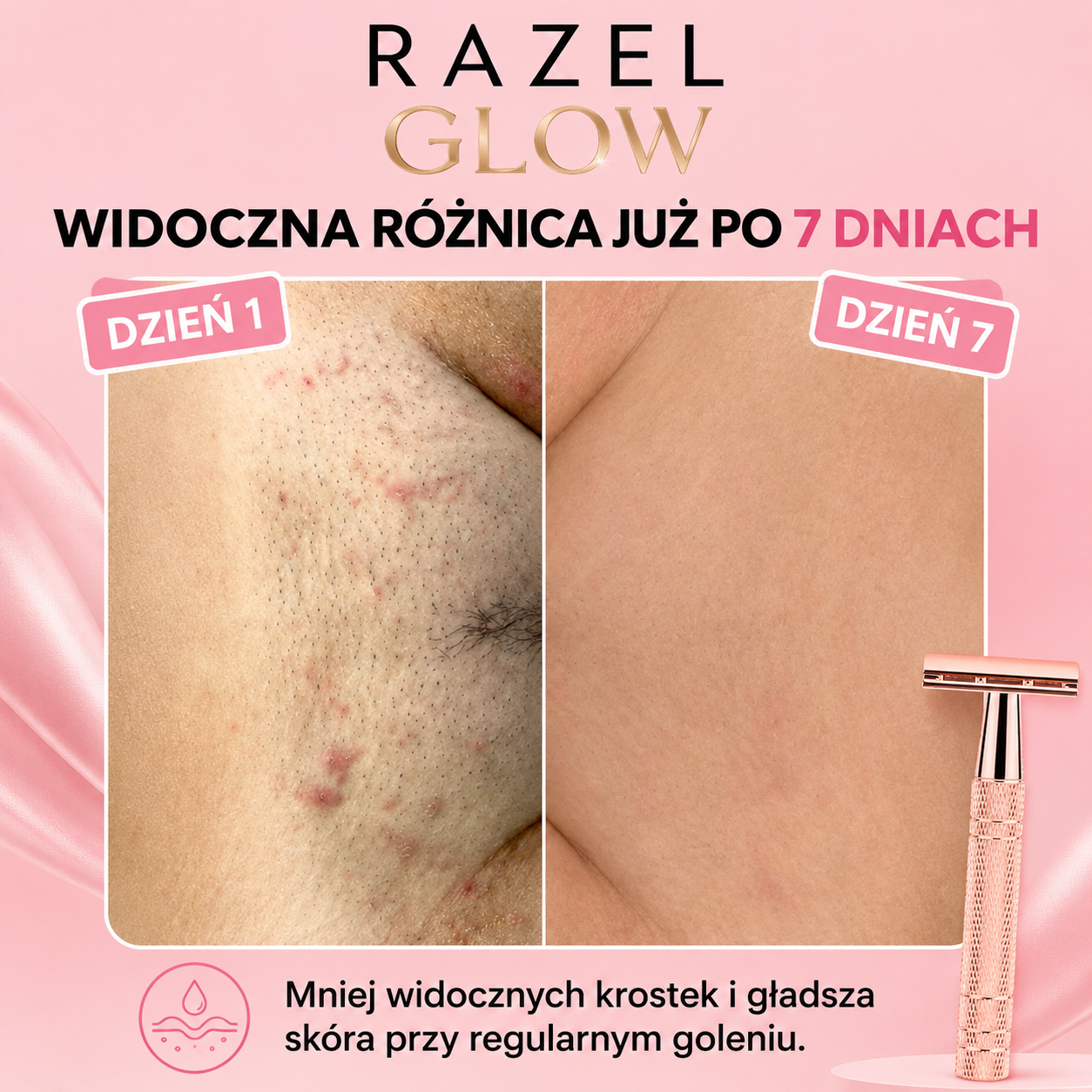 Maszynka RAZEL GLOW™ - Gładka skóra w kilka sekund ,efekt na zawsze