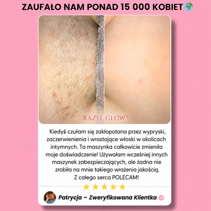 Maszynka RAZEL GLOW™ - Gładka skóra w kilka sekund ,efekt na zawsze