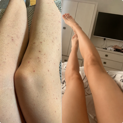 Maszynka RAZEL GLOW™ - Gładka skóra w kilka sekund ,efekt na zawsze