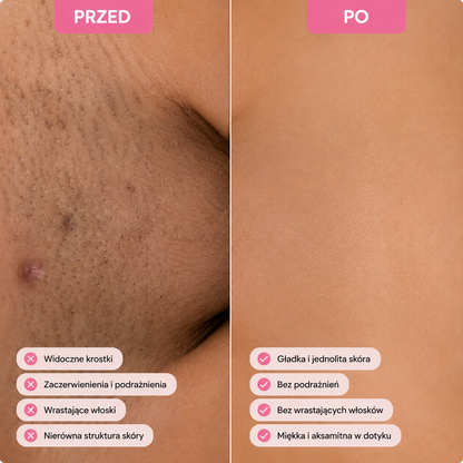 Maszynka RAZEL GLOW™ - Gładka skóra w kilka sekund ,efekt na zawsze